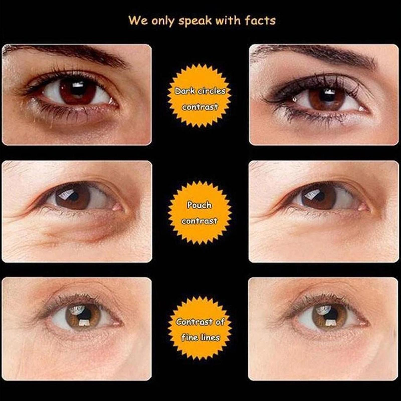 Anti-Wrinkle Eye Cream - Rarefinda.com