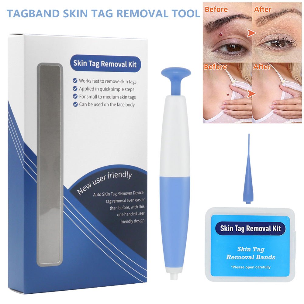 Skin Tag Removal Kit - Rarefinda.com